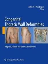 Bild Congenital Thoracic Wall Deformities